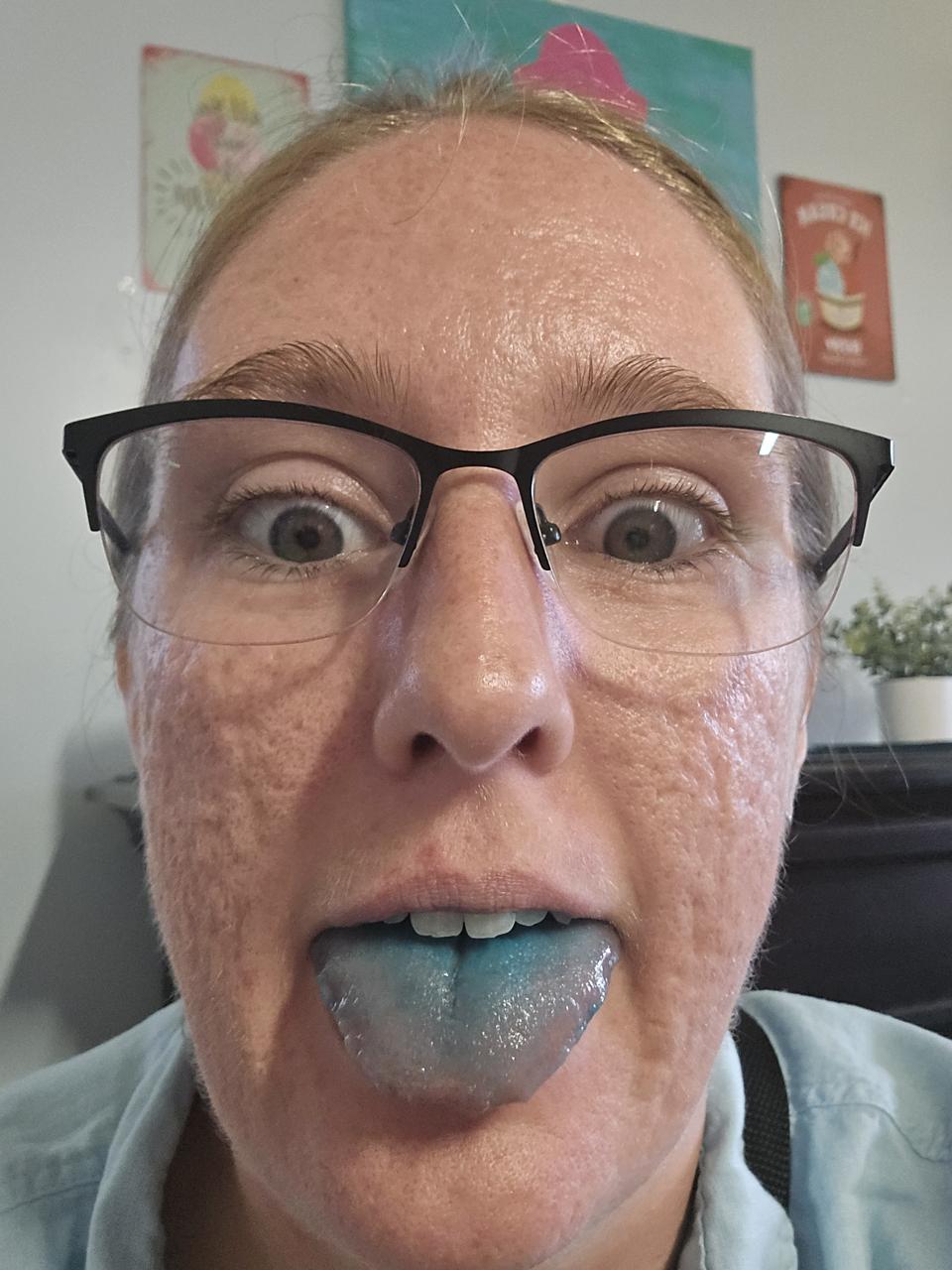 Cassie ate some blue food coloring with ice cream mixed in. Cassie with a blue tongue